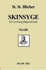 Skinsyge af St. St