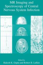 MR Imaging and Spectroscopy of Central Nervous System Infection