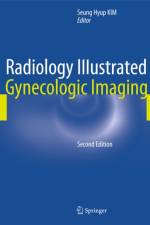 Radiology Illustrated: Gynecologic Imaging