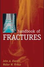 Handbook of Fractures, Third Edition af John Elstrom