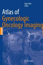 Atlas of Gynecologic Oncology Imaging