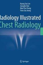 Radiology Illustrated: Chest Radiology af Kyung Soo Lee