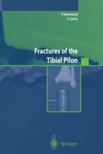 Fractures of the Tibial Pilon af P. Bartolozzi