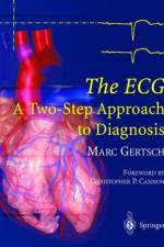 ECG af Marc Gertsch