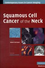 Squamous Cell Cancer of the Neck