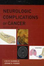 Neurologic Complications of Cancer af Lisa M. (Chair DeAngelis