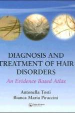 Diagnosis and Treatment of Hair Disorders af Antonella Tosti