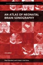 An Atlas of Neonatal Brain Sonography af Paul (Sophia Children's Hospital Govaert