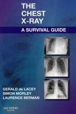 The Chest X-Ray: A Survival Guide af Gerald de Lacey