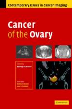 Cancer of the Ovary