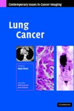 Lung Cancer