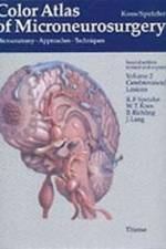 Color Atlas of Microneurosurgery: Volume 2 - Cerebrovascular Lesions af Wolfgang T. Koos