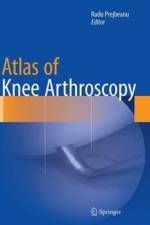 Atlas of Knee Arthroscopy