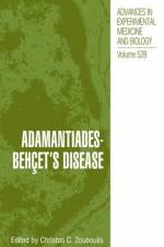 Adamantiades-Behcet's Disease