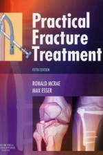 Practical Fracture Treatment af Ronald (Formerly Consultant Orthopaedic Surgeon McRae