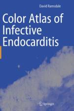 Color Atlas of Infective Endocarditis af David R. Ramsdale