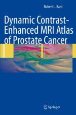 Dynamic Contrast-Enhanced MRI Atlas of Prostate Cancer af Robert L. Bard