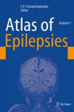 Atlas of Epilepsies