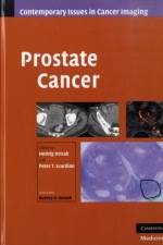 Prostate Cancer
