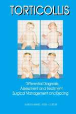 Torticollis af Karen Karmel-Ross