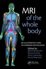 MRI of the Whole Body af Nikhil Bhuskute