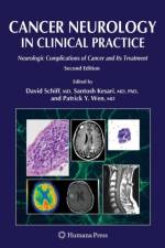 Cancer Neurology in Clinical Practice