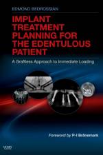 Implant Treatment Planning for the Edentulous Patient af Edmond (Diplomate Bedrossian