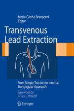 Transvenous Lead Extraction