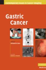 Gastric Cancer