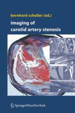Imaging of Carotid Artery Stenosis