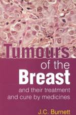 Tumours of the Breast af J C Burnett