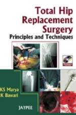 Total Hip Replacement Surgery af SKS Marya