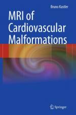 MRI of Cardiovascular Malformations af Bruno Kastler