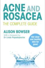 Acne and Rosacea af Alison Bowser