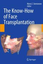 The Know-How of Face Transplantation