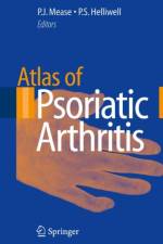 Atlas of Psoriatic Arthritis