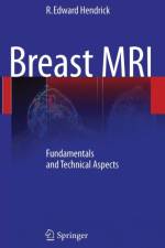 Breast MRI af R. Edward Hendrick