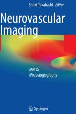 Neurovascular Imaging