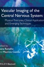 Vascular Imaging of the Central Nervous System af J Ramalho