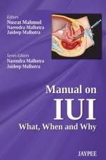 Manual on IUI: What, When and Why af Nusrat Mahmud