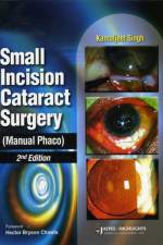 Small Incision Cataract Surgery (Manual Phaco) af Kamaljeet Singh