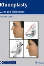 Rhinoplasty af Michael S. Godin