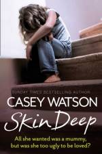 Skin Deep af Casey Watson