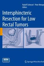 Intersphincteric Resection for Low Rectal Tumors