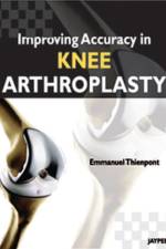Improving Accuracy in Knee Arthroplasty