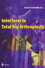 Interfaces in Total Hip Arthroplasty