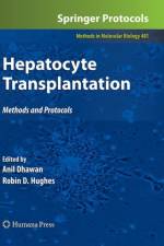 Hepatocyte Transplantation