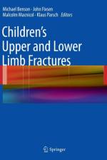 Children's Upper and Lower Limb Fractures