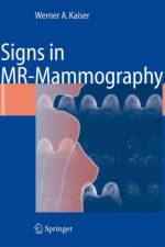 Signs in MR-Mammography af Werner A. Kaiser