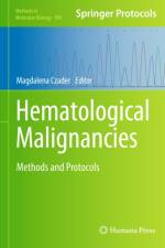 Hematological Malignancies